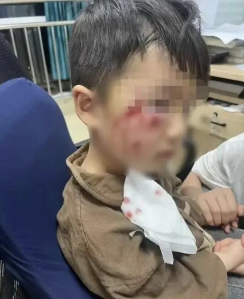 被瘋?cè)麤](méi)有“救命藥”，怎么辦？